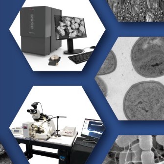 From sample preparation to imaging: Advances in Ultramicrotomy & SEM for Life Sciences